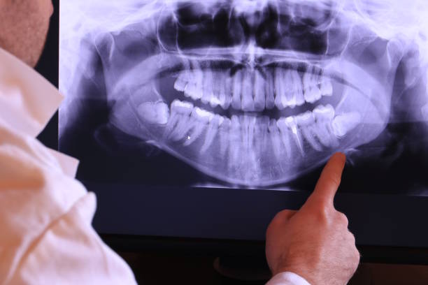 Best Emergency Denture Repair in Audubon, NJ